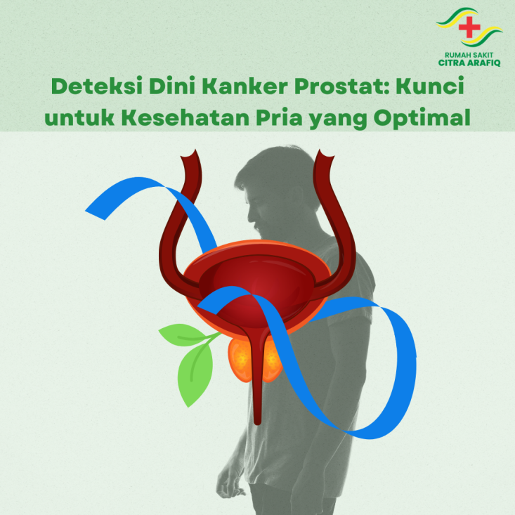 Deteksi Dini Kanker Prostat