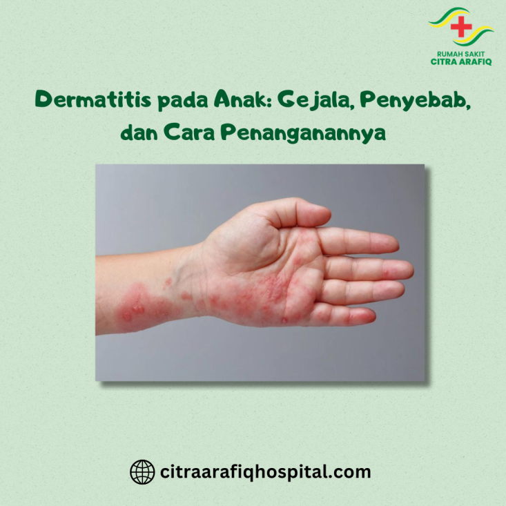 Dermatitis pada Anak: Gejala, Penyebab, dan Cara Penanganannya